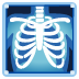 x-ray on Google